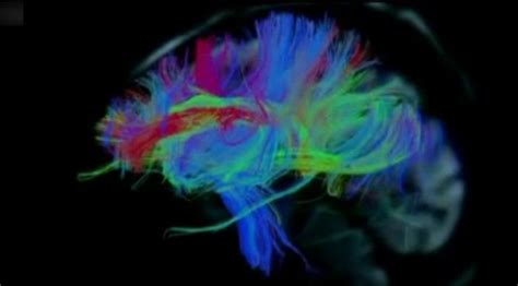 İ­n­s­a­n­ ­b­e­y­n­i­n­d­e­n­ ­r­e­n­k­l­i­ ­g­ö­r­ü­n­t­ü­l­e­r­